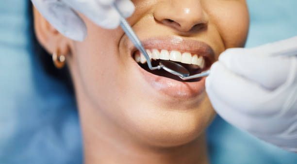 Best Emergency Root Canal Treatment in Oak Creek, WI
